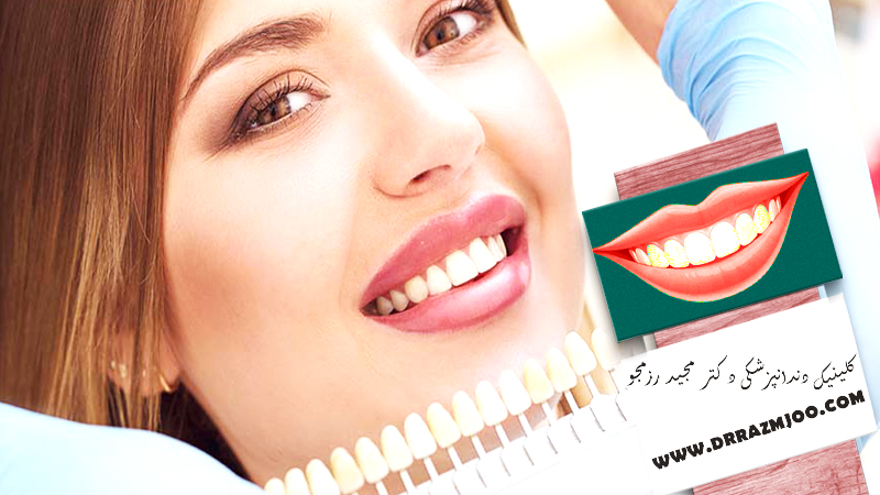 بهترین کلینیک دندانپزشکی زیبایی در اصفهان | دکتر مجید رزمجو