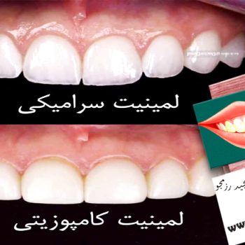 بهترین کلینیک دندانپزشکی زیبایی در اصفهان | دکتر مجید رزمجو