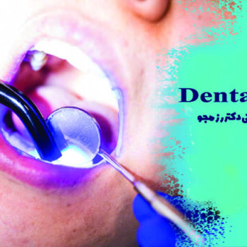 کامپوزیت دندان در اصفهان