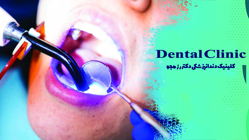 کامپوزیت دندان در اصفهان