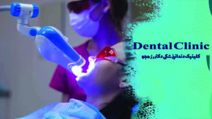 بلیچینگ دندان در اصفهان