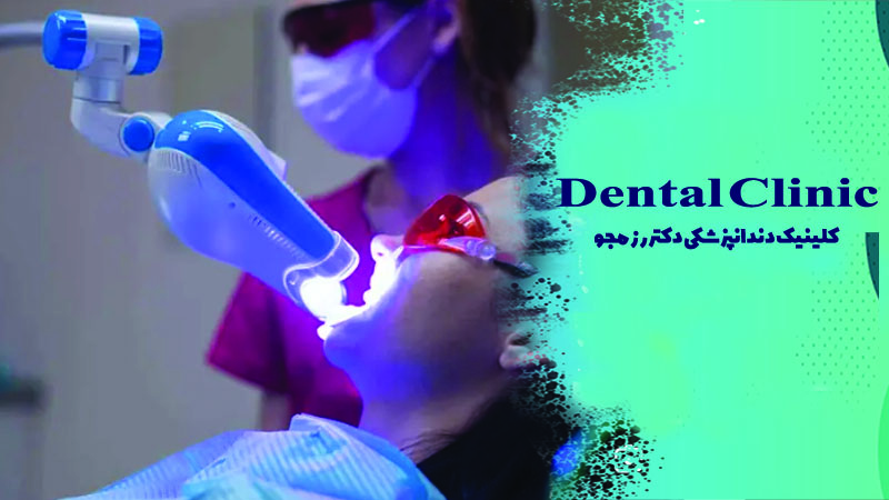 بلیچینگ دندان در اصفهان