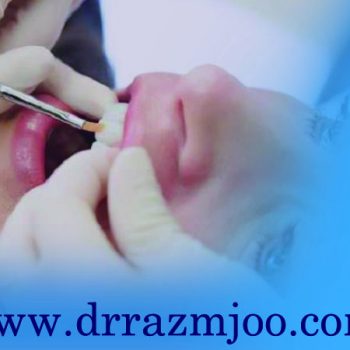 کامپوزیت دندان در اصلاح بدون مداخله زیستگاه های دهان