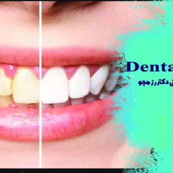 تاثیر بلیچینگ دندان بر روی اعتماد به نفس افراد