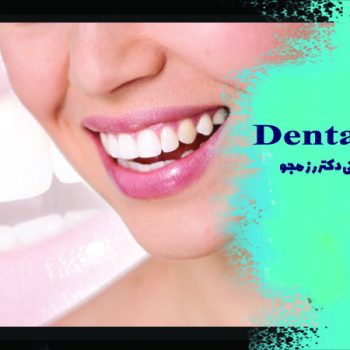 بلیچینگ لیزری