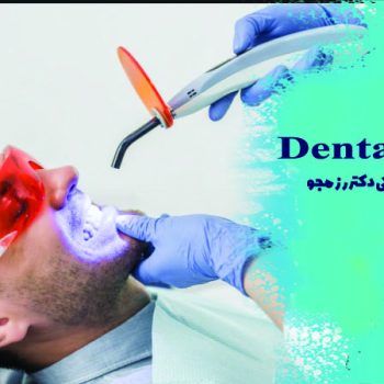 بلیچینگ دندان و تاثیرات آن بر افزایش روشنایی دندان ها