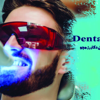 تفاوت بلیچینگ مطب و خانگی