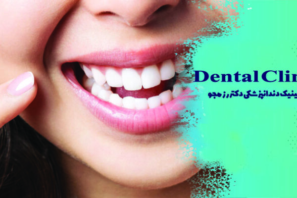 بلیچینگ دندان