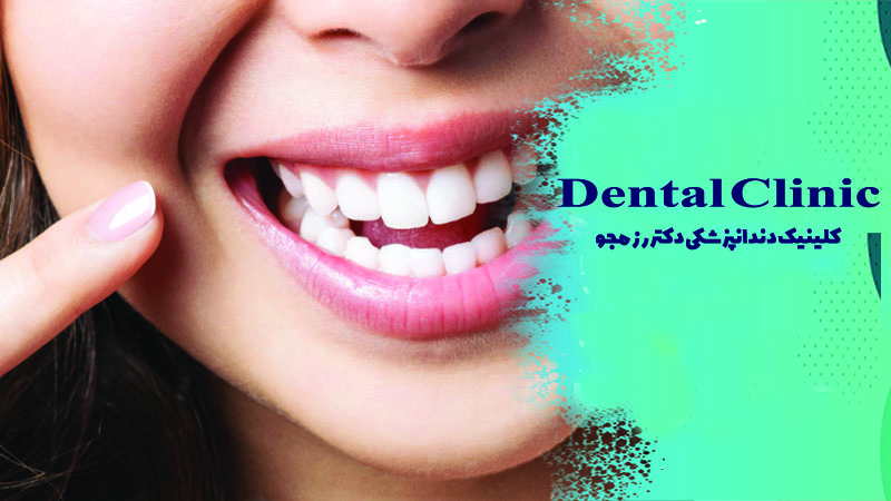 بلیچینگ دندان