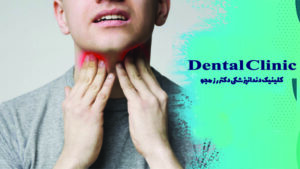 گلودرد بعد از عصب کشی دندان