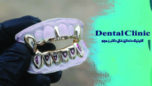 گریلز دندان