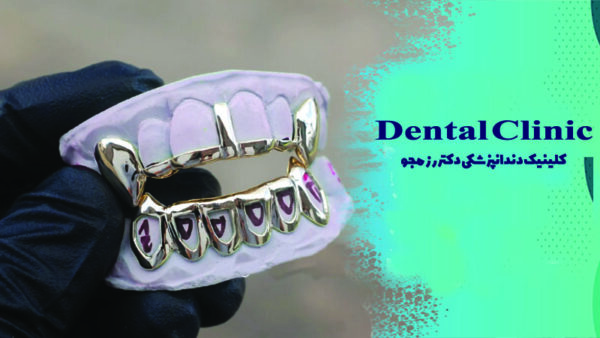 گریلز دندان