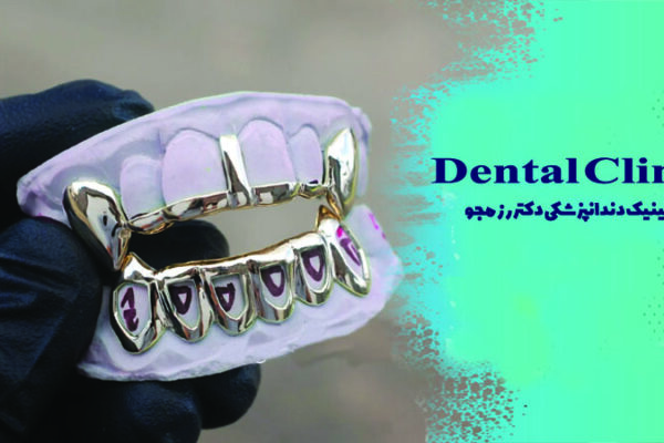 گریلز دندان