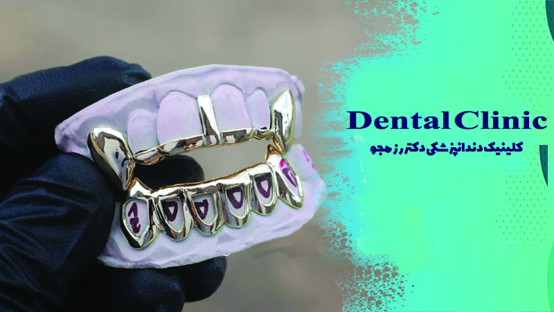 گریلز دندان