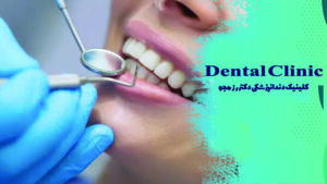 کانتورینگ دندان چیست