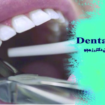 کشیدن دندان عفونی