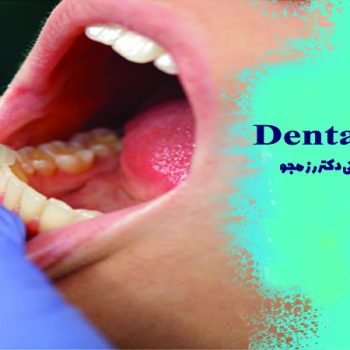 کانتورینگ دندان چیست