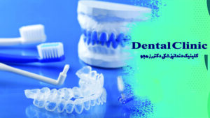 ژل بلیچینگ دندان