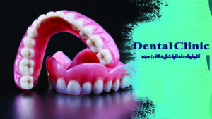 پروتز دندان چیست؟