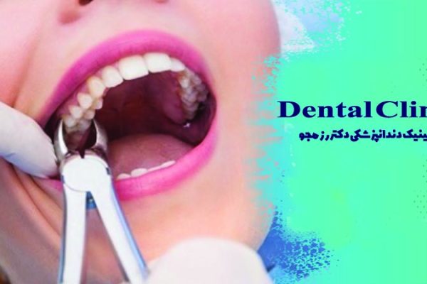چگونگی عصب کشی دندان
