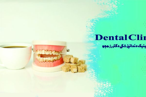 تأثیر مصرف چای بر ایمپلنت دندان