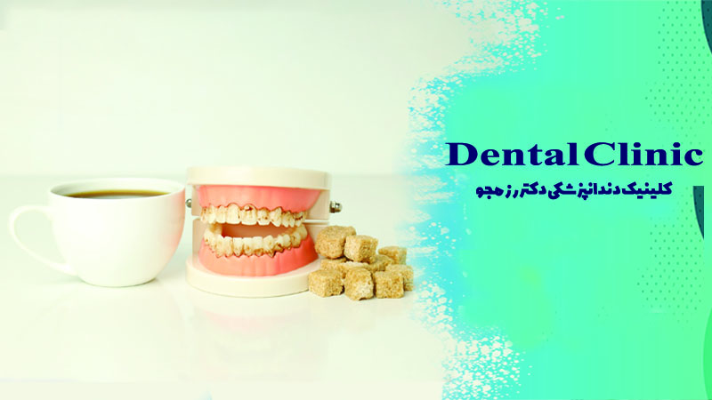 تأثیر مصرف چای بر ایمپلنت دندان