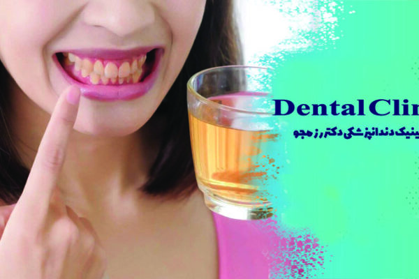 تأثیر مصرف چای بر ایمپلنت دندان
