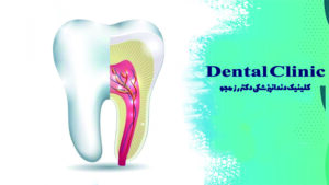 پالپ دندان چیست