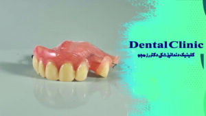 پارسیل آکریلی