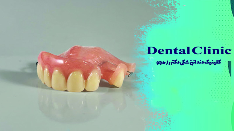 پارسیل آکریلی