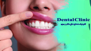 ویتامین های تقویت کننده لثه