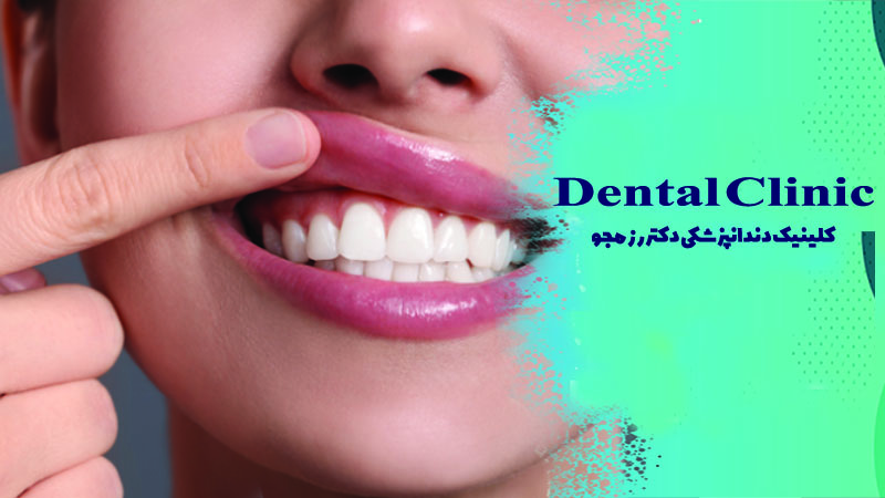 ویتامین های تقویت کننده لثه