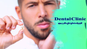 تورم صورت بعد از جراحی دندان عقل