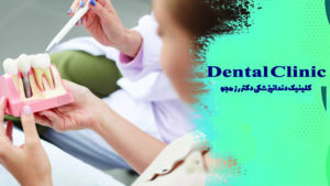 تورم بعد از ایمپلنت