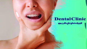 ورم لب بعد از عصب کشی