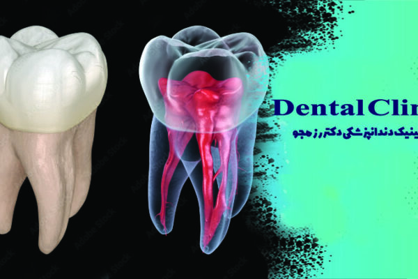 دندان چند کانال عصبی دارد