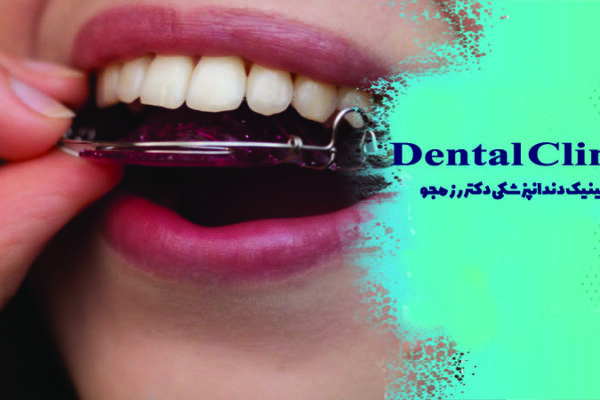 نگهدارنده ارتودنسی چیست