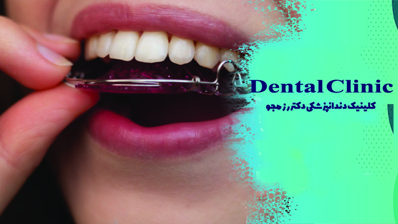 نگهدارنده ارتودنسی چیست