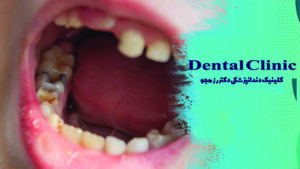 علائم عفونت دندان