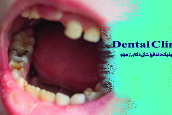 علائم عفونت دندان