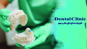 نحوه قالب گیری از دندان