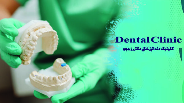 نحوه قالب گیری از دندان