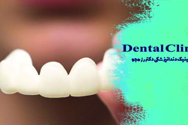 نحوه قالب گیری اسنپ اسمایل