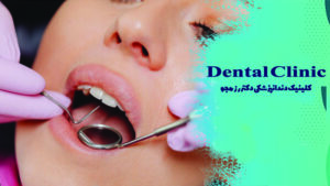 نحوه عصب کشی دندان جلو