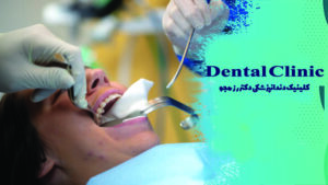 مراحل جراحی دندان عقل نهفته