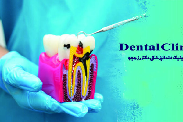 درمان پوسیدگی عمیق دندان