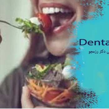 چند روز بعد از ایمپلنت می‌توان غذا خورد