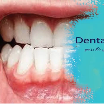 سلامت لثه برای بزرگسالان
