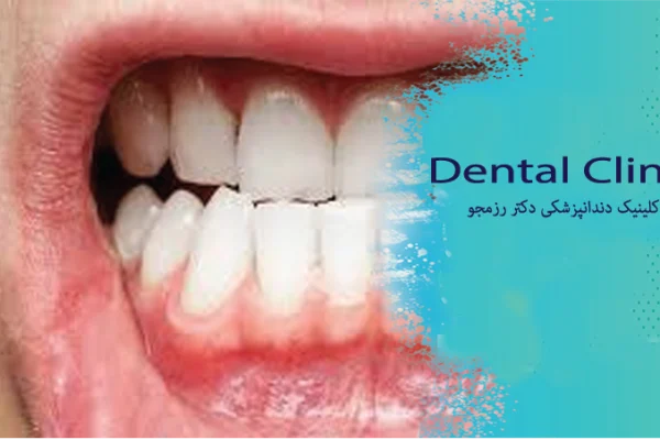 سلامت لثه برای بزرگسالان