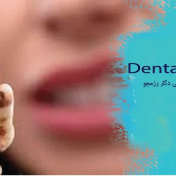 مراقبت‌های بعد از عصب‌کشی دندان